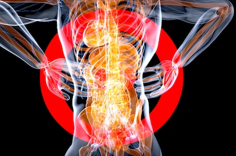 你的腰酸背痛，肾衰竭惹得祸？